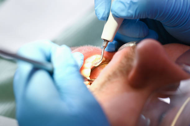 Best Emergency Dental Care for Sports Injuries in USA