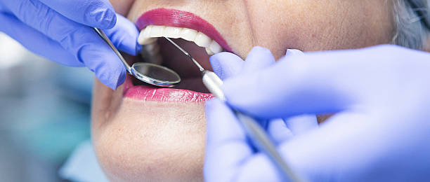 Best Emergency Cosmetic Dentistry (e.g., broken veneers) in USA